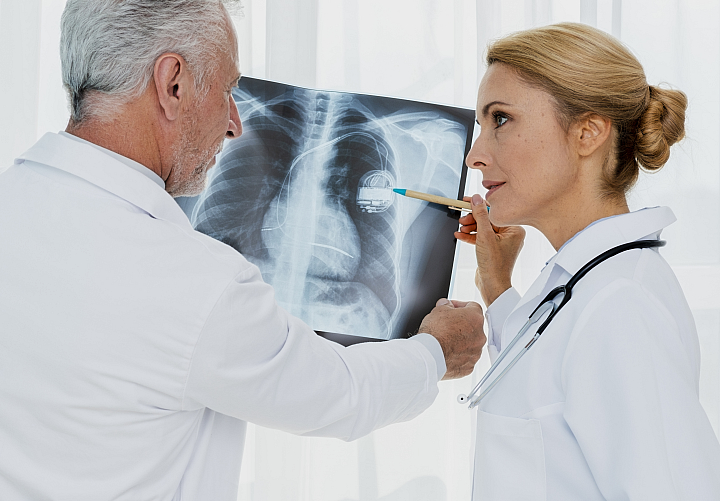 Marcapasos Estimulación cardiaca